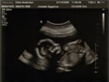 Baby 8